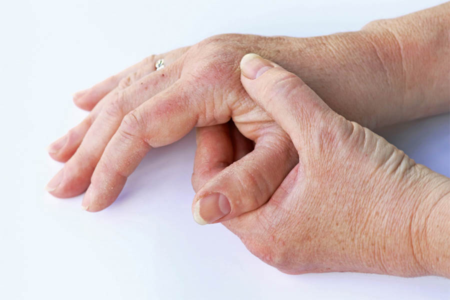Bệnh Gout Hay Bệnh Gút Là Gì? Nguyên Nhân Và Cách Điều Trị Bệnh Gout