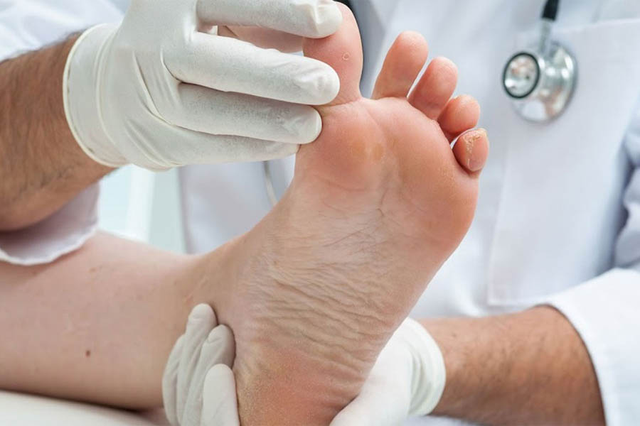 Bệnh Gout Hay Bệnh Gút Là Gì? Nguyên Nhân Và Cách Điều Trị Bệnh Gout