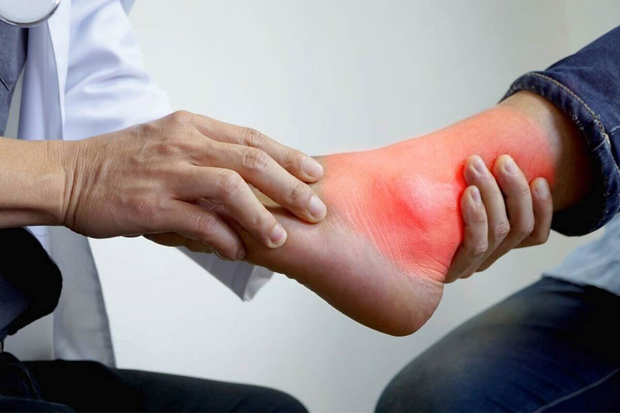 Bệnh Gout Hay Bệnh Gút Là Gì? Nguyên Nhân Và Cách Điều Trị Bệnh Gout