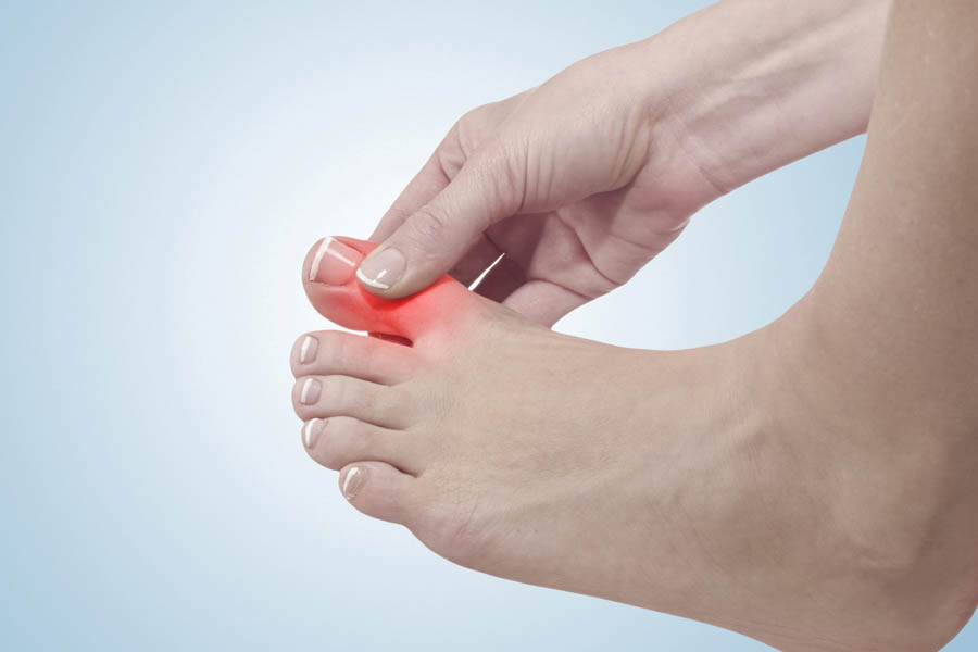 Bệnh Gout Hay Bệnh Gút Là Gì? Nguyên Nhân Và Cách Điều Trị Bệnh Gout