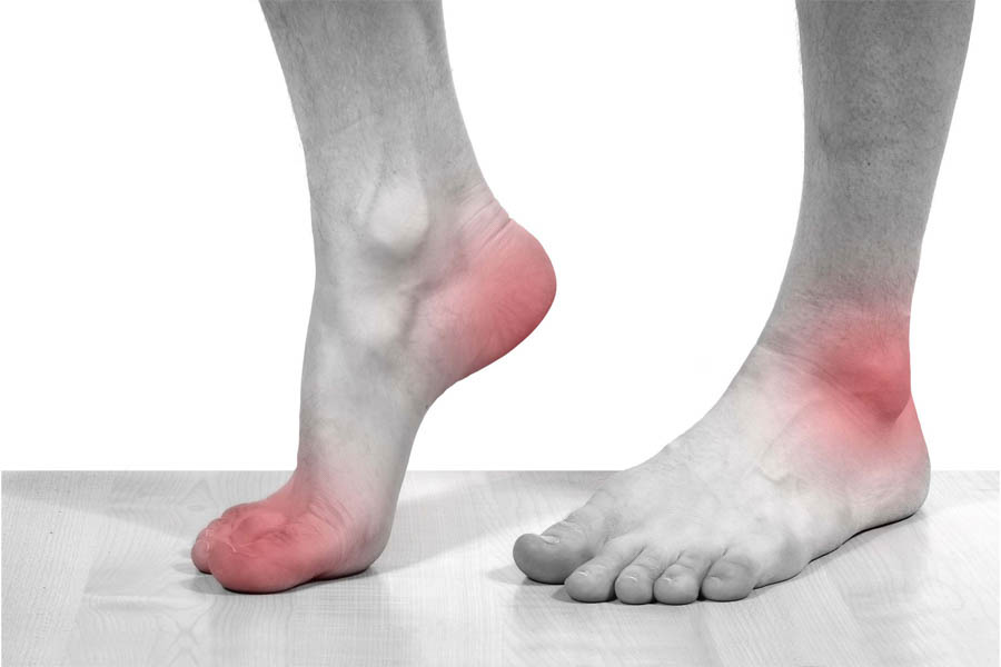 Bệnh Gout Hay Bệnh Gút Là Gì? Nguyên Nhân Và Cách Điều Trị Bệnh Gout