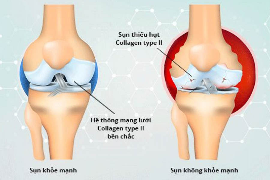 Collagen Là Gì? Top Những Thực Phẩm Bổ Sung Collagen Nhiều Nhất