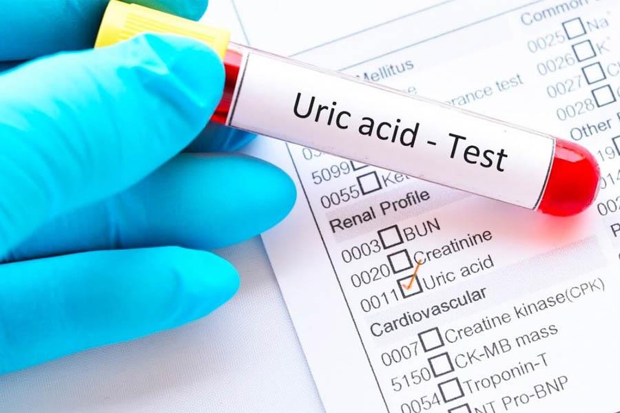 Dấu Hiệu Bệnh Gout Ở Chân Cần Lưu Ý Để Chữa Trị Kịp Thời
