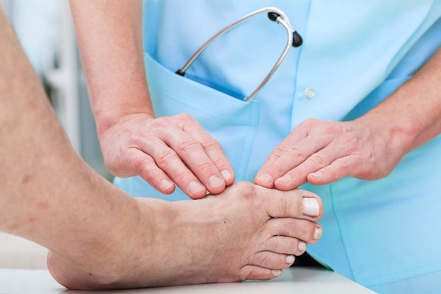 Dấu Hiệu Bệnh Gout Ở Chân Cần Lưu Ý Để Chữa Trị Kịp Thời