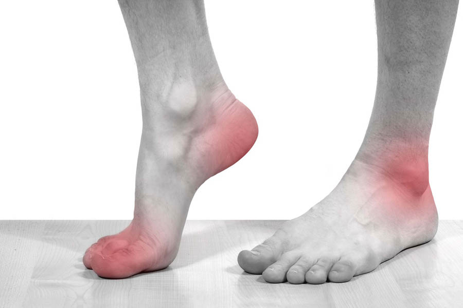 Tìm Hiểu Những Nguyên Nhân Bệnh Gout Và Biến Chứng