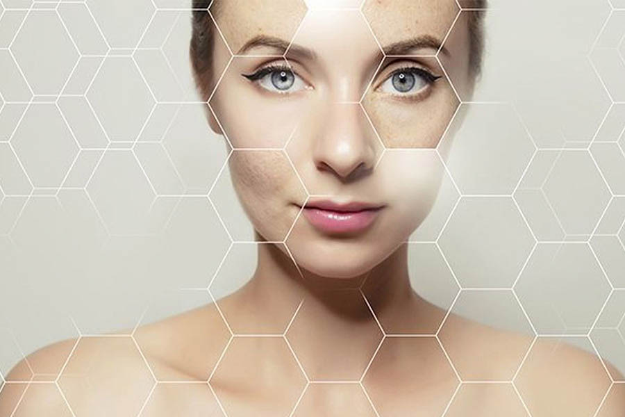Trả Lời Thắc Mắc Có Nên Uống Collagen Liên Tục Không 2 Trả Lời Thắc Mắc Có Nên Uống Collagen Liên Tục Không