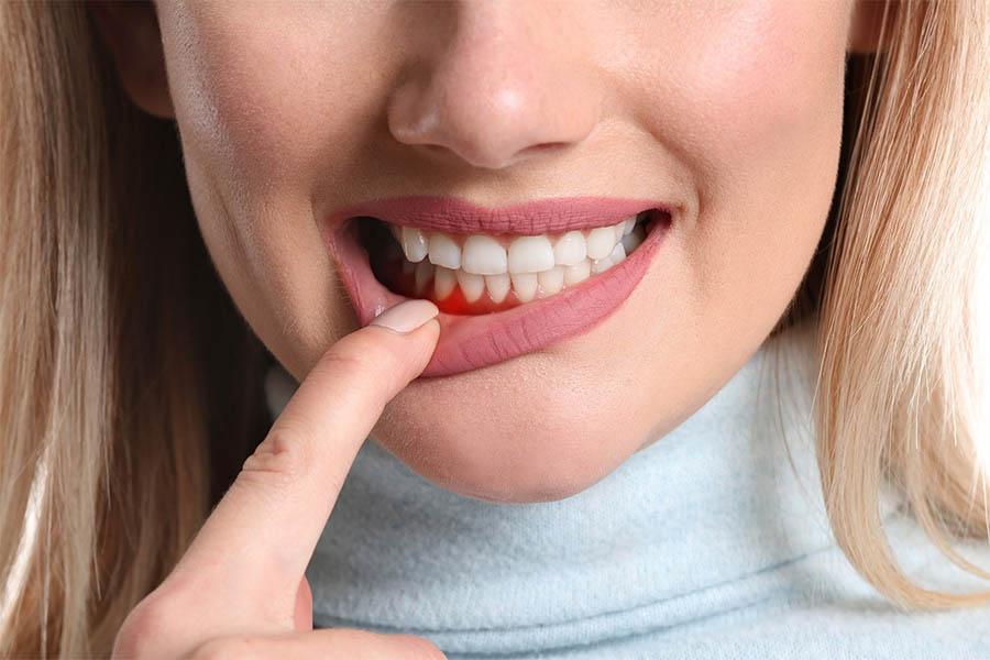 Trả Lời Thắc Mắc Có Nên Uống Collagen Liên Tục Không 4 Trả Lời Thắc Mắc Có Nên Uống Collagen Liên Tục Không