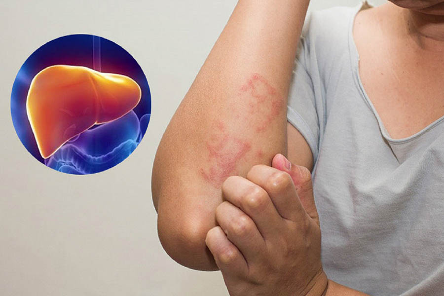 Có Nên Uống Trà Giải Độc Gan Hay Không?